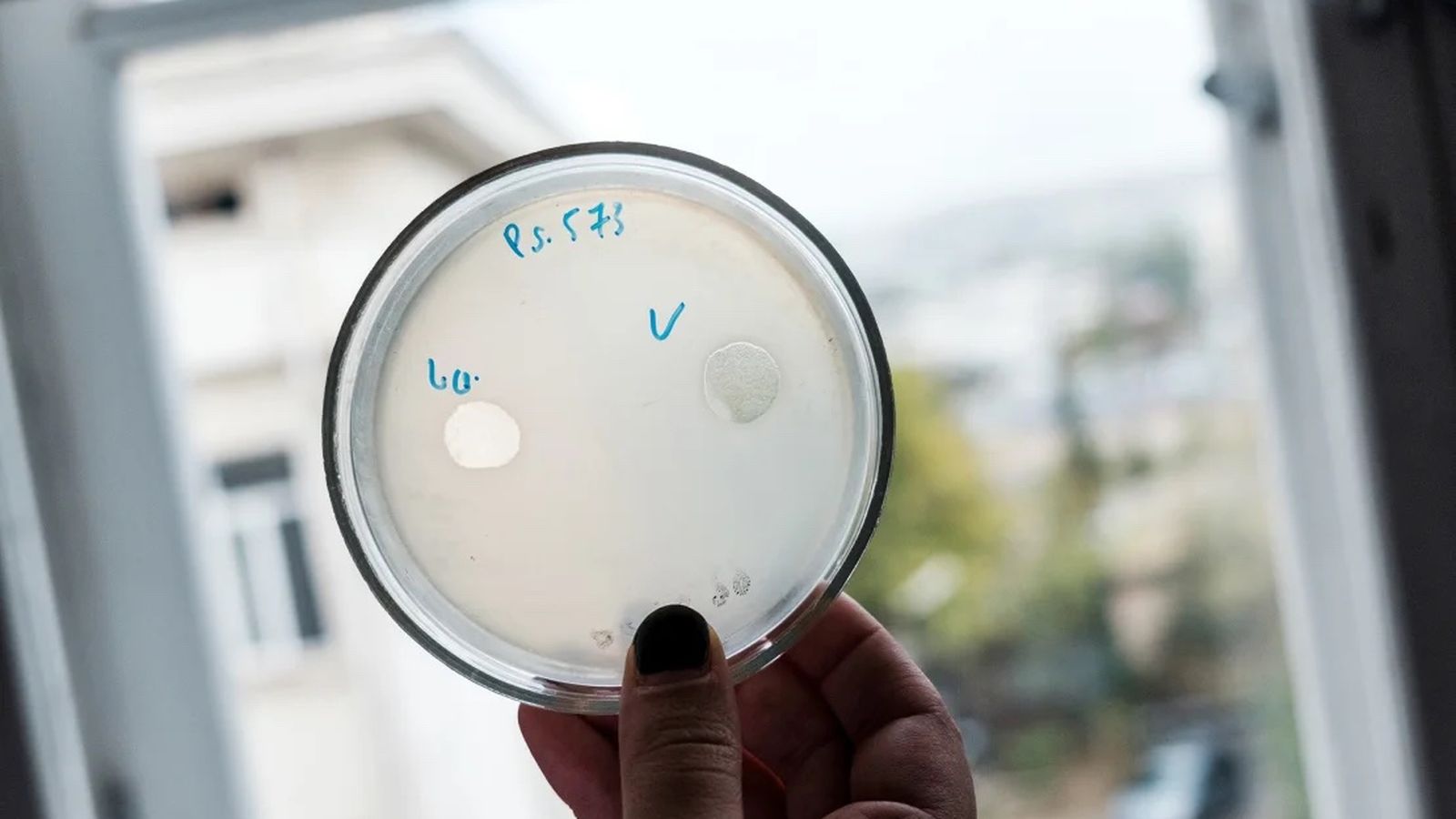 Cultures of phages are being examined at the Eliava Institute in Tbilisi, Georgia, where phages have been used to treat infections for decades.