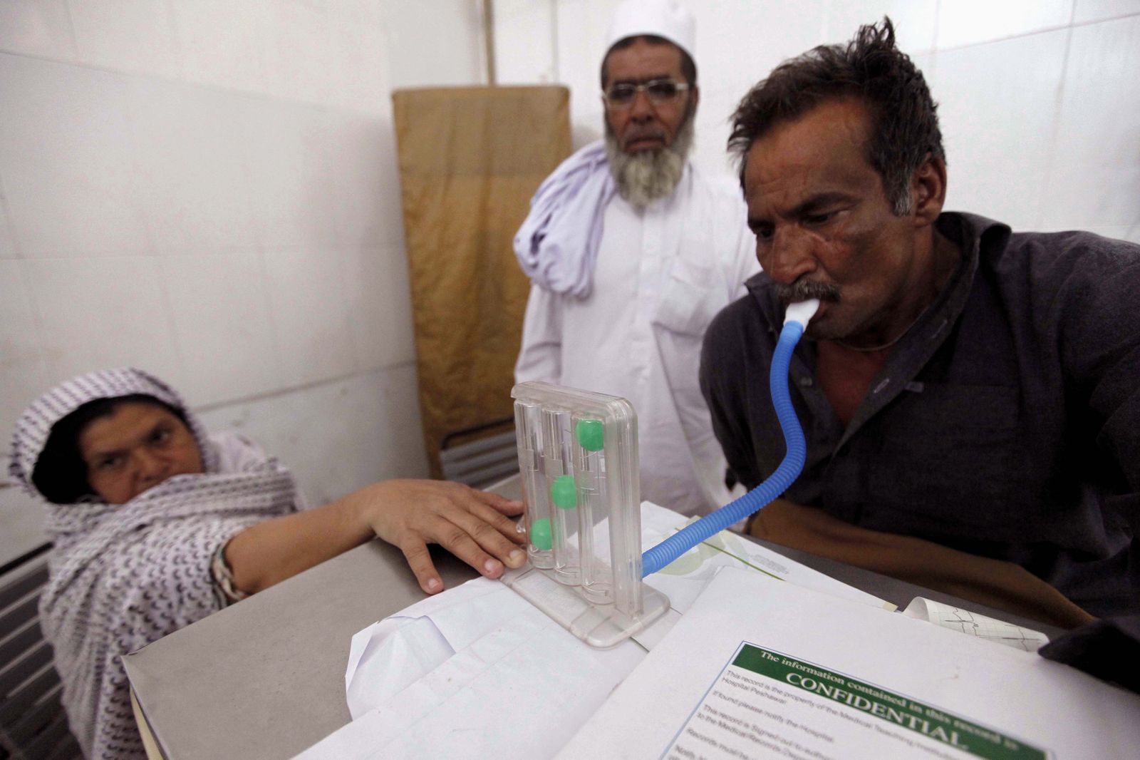 Las muertes por tuberculosis subieron en Europa por primera vez en dos décadas